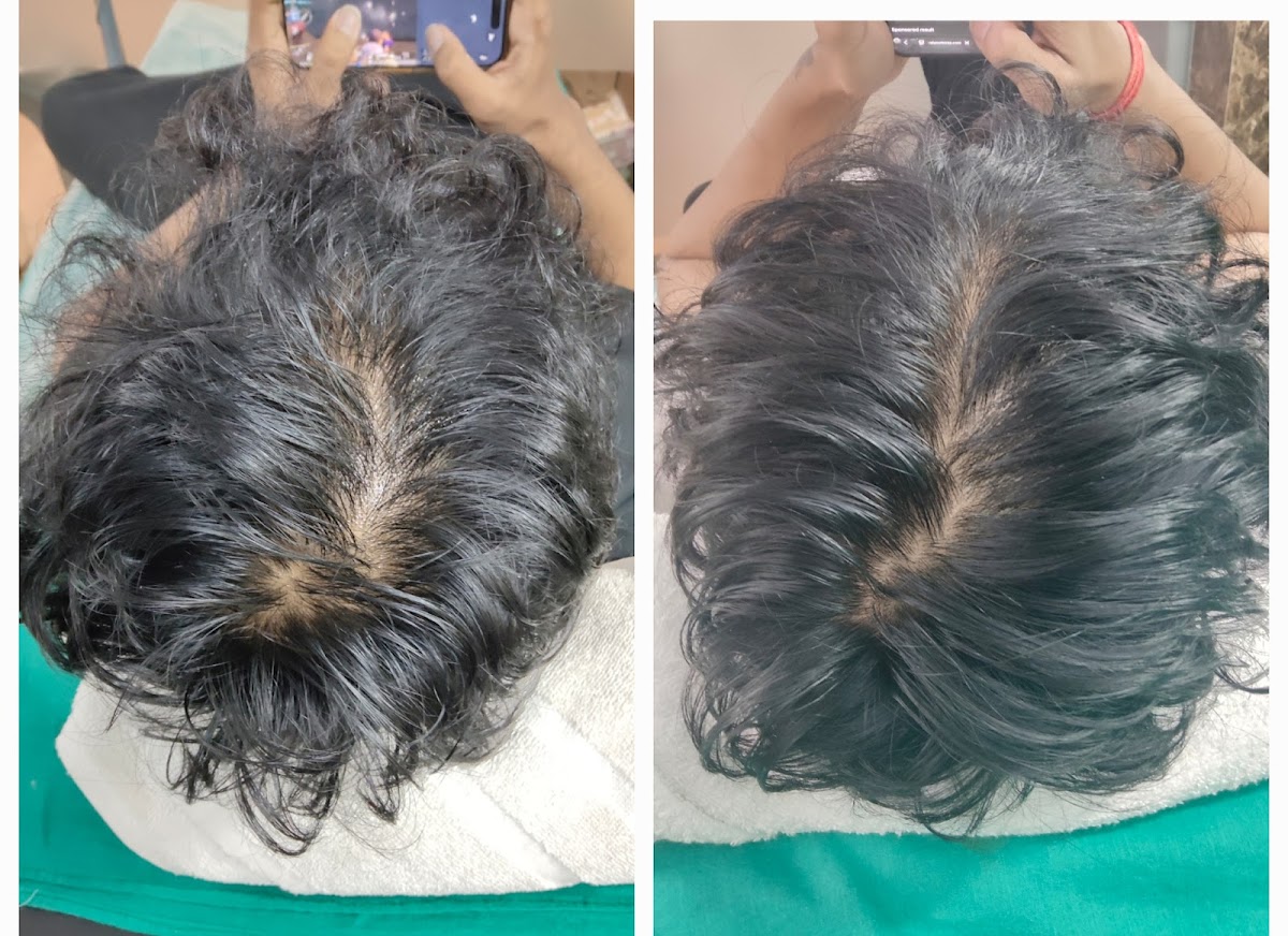 Dr Disha's Hair & Skin Clinic - Beauty Parlour in Cantonment, 