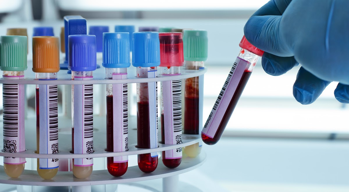 Vimal Diagnostic Centre - Diagnostic Centres in Alambagh, Lucknow
