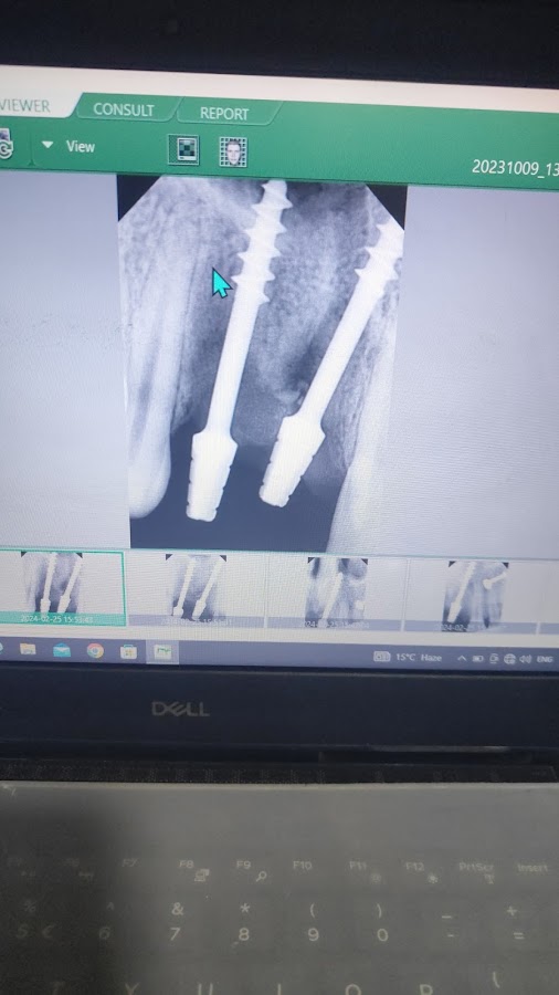 The Dental Clinic And Implant Center